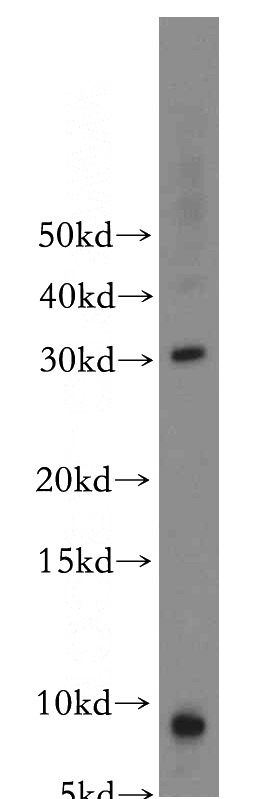 mouse skeletal muscle tissue were subjected to SDS PAGE followed by western blot with Catalog No:109502(COX8A antibody) at dilution of 1:2000