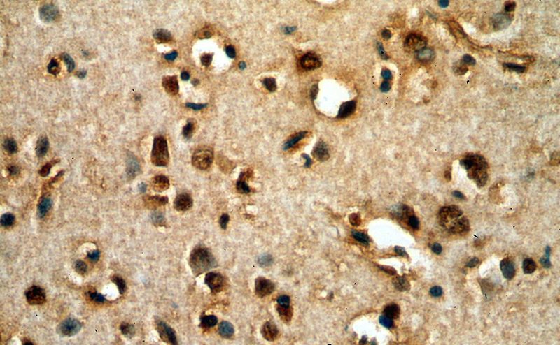 Immunohistochemical of paraffin-embedded human brain using Catalog No:114071(POU3F3-Specific antibody) at dilution of 1:100 (under 40x lens)