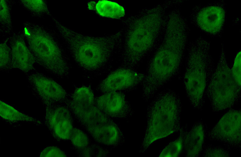 Immunofluorescent analysis of (10% Formaldehyde) fixed A431 cells using Catalog No:107193(ERCC1 Antibody) at dilution of 1:50 and Alexa Fluor 488-congugated AffiniPure Goat Anti-Mouse IgG(H+L)