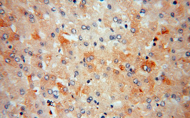 Immunohistochemical of paraffin-embedded human liver using Catalog No:112574(ME1 antibody) at dilution of 1:100 (under 40x lens)