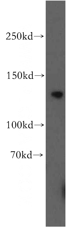 PC-3 cells were subjected to SDS PAGE followed by western blot with Catalog No:116405(TRPC1 antibody) at dilution of 1:500