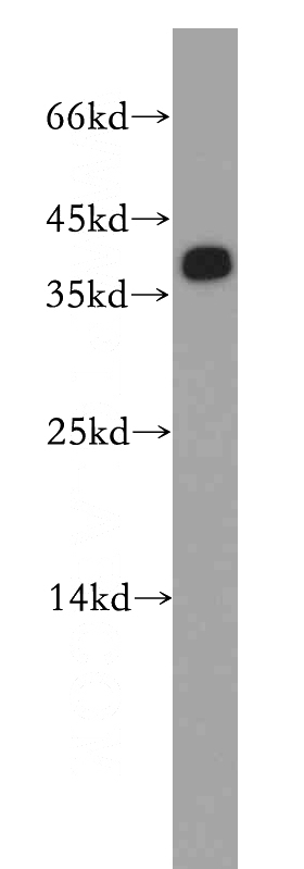 mouse brain tissue were subjected to SDS PAGE followed by western blot with Catalog No:115149(SFRS2 antibody) at dilution of 1:300