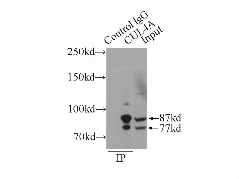 IP Result of anti-CUL4A (IP:Catalog No:107182, 4ug; Detection:Catalog No:107182 1:500) with MCF-7 cells lysate 2800ug.