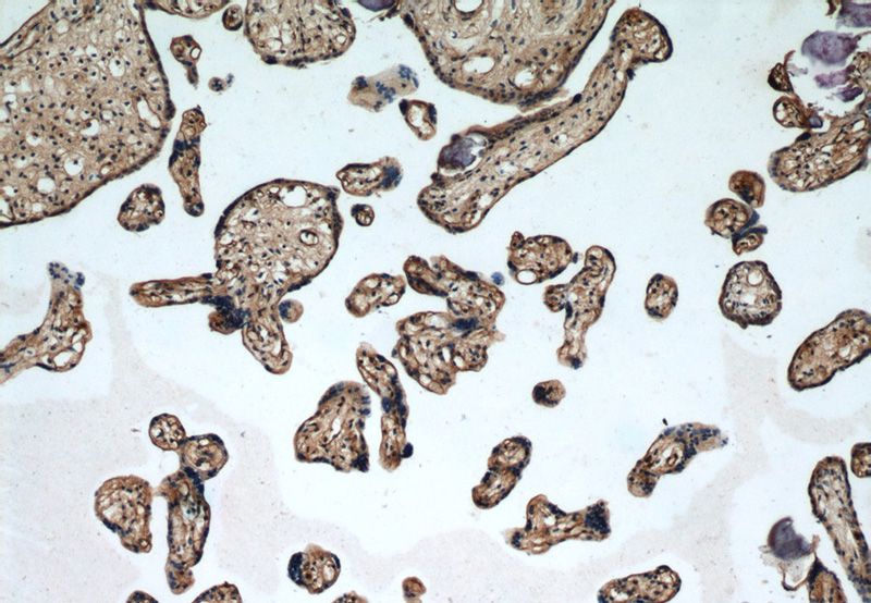 Immunohistochemical of paraffin-embedded human placenta using Catalog No:108169(ARPC5L antibody) at dilution of 1:50 (under 10x lens)