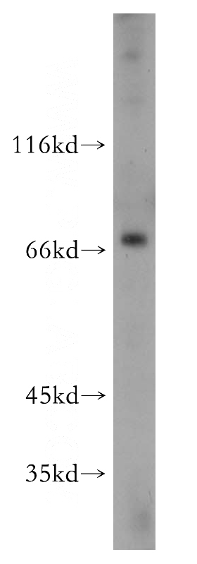 HepG2 cells were subjected to SDS PAGE followed by western blot with Catalog No:115362(SLC27A2 antibody) at dilution of 1:500