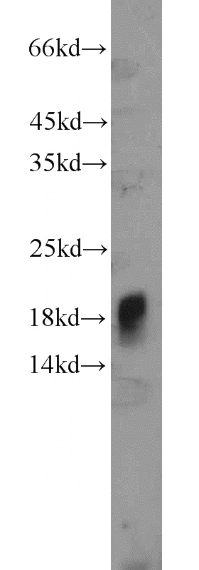 mouse pancreas tissue were subjected to SDS PAGE followed by western blot with Catalog No:111665(IFT20 antibody) at dilution of 1:400