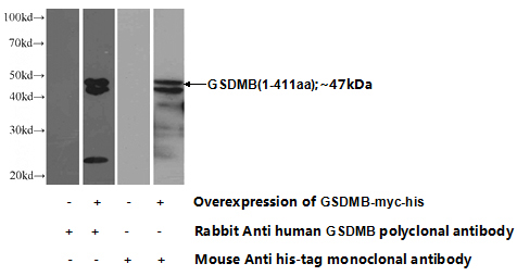 Transfected HEK-293 cells were subjected to SDS PAGE followed by western blot with Catalog No:111165(GSDMB Antibody) at dilution of 1:1000