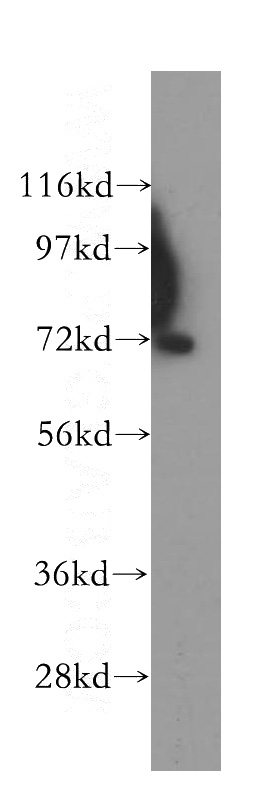 human liver tissue were subjected to SDS PAGE followed by western blot with Catalog No:115196(SERPINA10 antibody) at dilution of 1:500