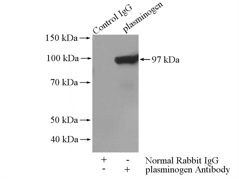 IP Result of anti-PLG (IP:Catalog No:113942, 2ug; Detection:Catalog No:113942 1:500) with human plasma tissue lysate 4000ug.