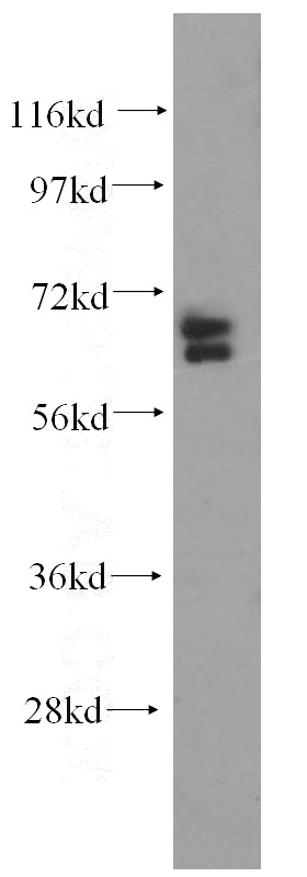 Jurkat cells were subjected to SDS PAGE followed by western blot with Catalog No:108179(ARHGAP9 antibody) at dilution of 1:500