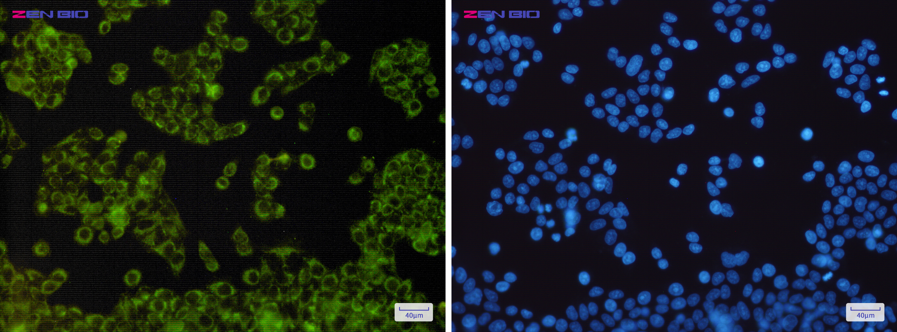 Immunocytochemistry of NDUFB9(green) in Hela cells using NDUFB9 Rabbit mAb at dilution 1/200, and DAPI(blue)