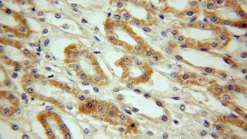 Immunohistochemical of paraffin-embedded human kidney using Catalog No:107466(PFN2 antibody) at dilution of 1:100 (under 40x lens)