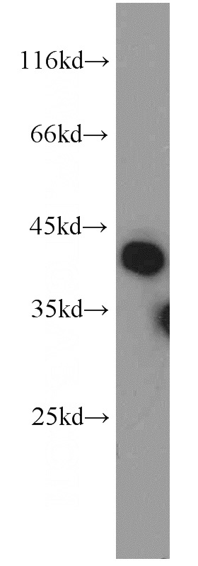 HL-60 cells were subjected to SDS PAGE followed by western blot with Catalog No:114706(RIMS3 antibody) at dilution of 1:500