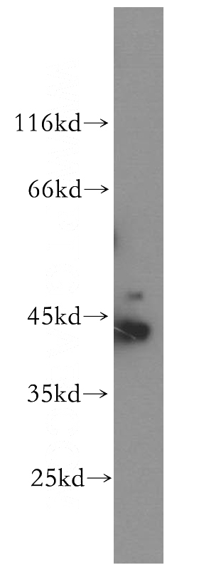 HEK-293 cells were subjected to SDS PAGE followed by western blot with Catalog No:109544(CKB-Specific antibody) at dilution of 1:1000