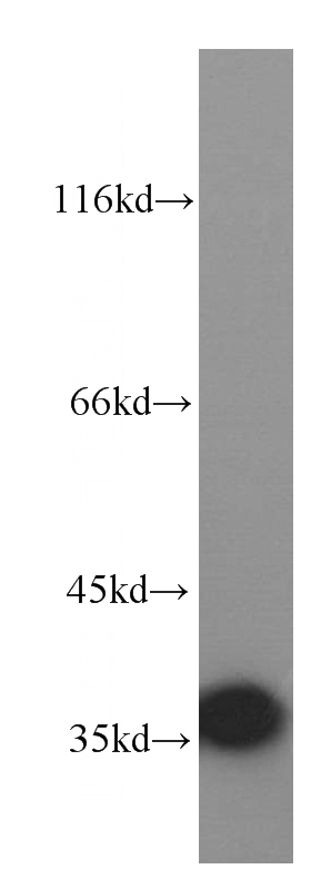 A431 cells were subjected to SDS PAGE followed by western blot with Catalog No:112183(LDHA-Specific antibody) at dilution of 1:2000