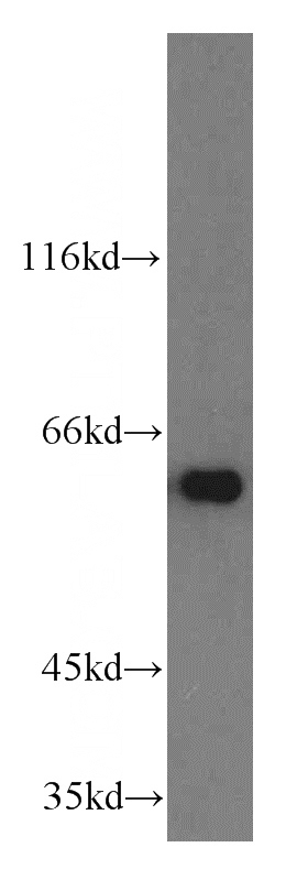 HEK-293 cells were subjected to SDS PAGE followed by western blot with Catalog No:115948(TERF2IP antibody) at dilution of 1:800