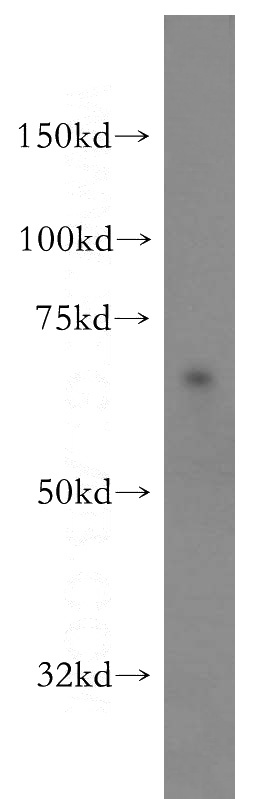 NIH/3T3 cells were subjected to SDS PAGE followed by western blot with Catalog No:115134(SF3A2 antibody) at dilution of 1:400