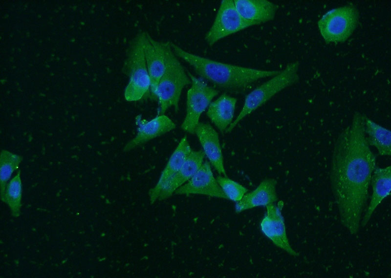 Immunofluorescent analysis of A375 cells using Catalog No:113823(PHLDA1 Antibody) at dilution of 1:50 and Alexa Fluor 488-congugated AffiniPure Goat Anti-Rabbit IgG(H+L)