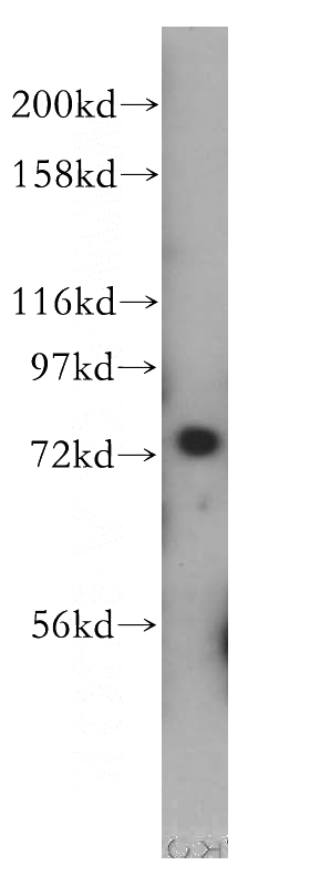 Jurkat cells were subjected to SDS PAGE followed by western blot with Catalog No:109093(CDC16 antibody) at dilution of 1:500