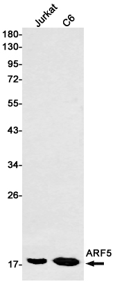 Western blot detection of ARF5 in Jurkat,C6 cell lysates using ARF5 Rabbit mAb(1:1000 diluted).Predicted band size:21kDa.Observed band size:18kDa.