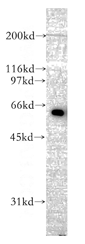 mouse testis tissue were subjected to SDS PAGE followed by western blot with Catalog No:107826(AGFG1 antibody) at dilution of 1:400