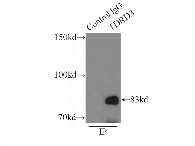 IP Result of anti-TDRD3 (IP:Catalog No:115928, 3ug; Detection:Catalog No:115928 1:1000) with HeLa cells lysate 3800ug.