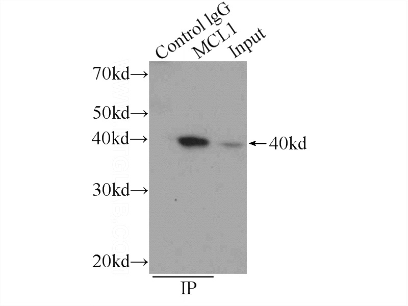 IP Result of anti-MCL1 (IP:Catalog No:112549, 3ug; Detection:Catalog No:112549 1:1000) with Raji cells lysate 800ug.