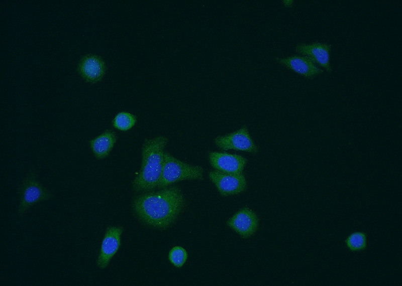 Immunofluorescent analysis of HepG2 cells using Catalog No:113306(NOSTRIN Antibody) at dilution of 1:50 and Alexa Fluor 488-congugated AffiniPure Goat Anti-Rabbit IgG(H+L)