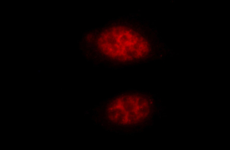 Immunofluorescent analysis of HepG2 cells, using HAT1 antibody Catalog No:111260 at 1:25 dilution and Rhodamine-labeled goat anti-rabbit IgG (red).