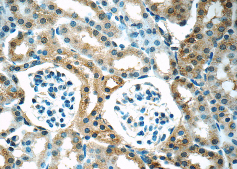Immunohistochemistry of paraffin-embedded mouse kidney tissue slide using Catalog No:115273(SHH Antibody) at dilution of 1:50 (under 40x lens)