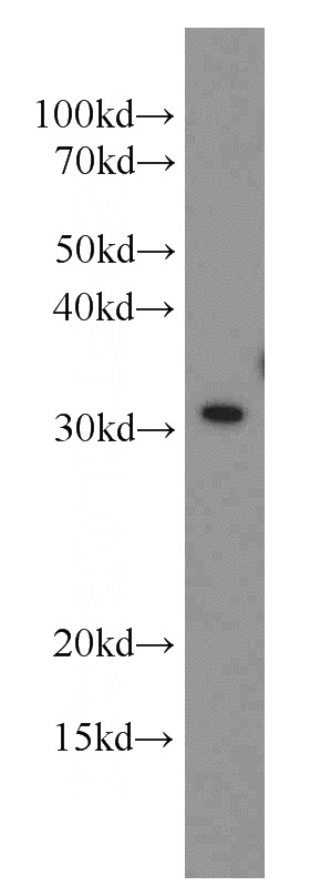 Jurkat cells were subjected to SDS PAGE followed by western blot with Catalog No:112593(MED6 antibody) at dilution of 1:500