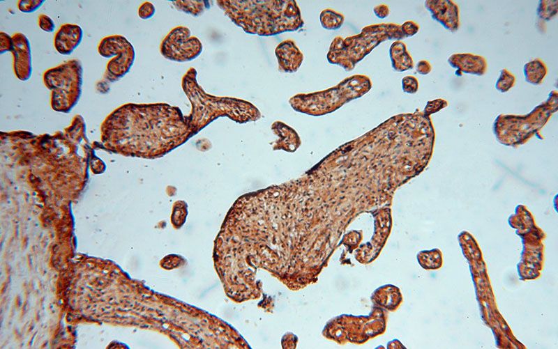 Immunohistochemical of paraffin-embedded human placenta using Catalog No:111912(KARS antibody) at dilution of 1:100 (under 10x lens)