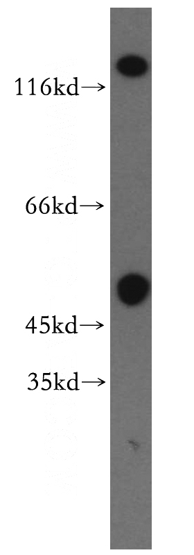 human brain tissue were subjected to SDS PAGE followed by western blot with Catalog No:111207(GRIK2 antibody) at dilution of 1:300