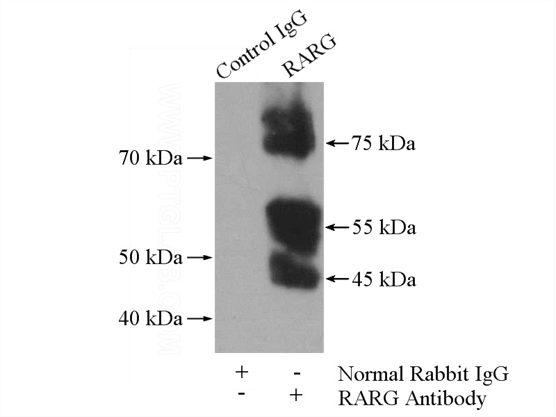 IP Result of anti-RARG (IP:Catalog No:114469, 4ug; Detection:Catalog No:114469 1:300) with MCF-7 cells lysate 1120ug.