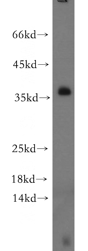 Jurkat cells were subjected to SDS PAGE followed by western blot with Catalog No:112154(LAT antibody) at dilution of 1:300