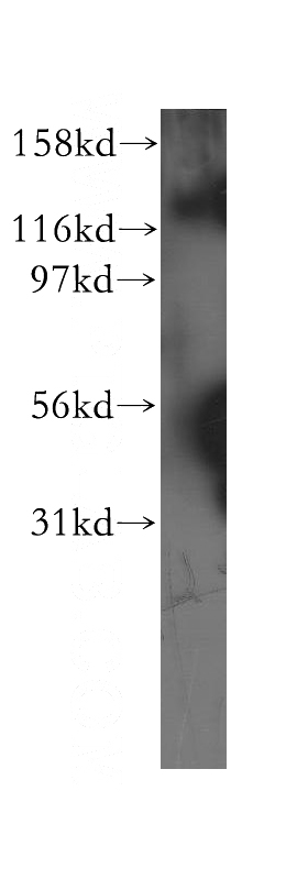 BxPC-3 cells were subjected to SDS PAGE followed by western blot with Catalog No:116602(USP25 antibody) at dilution of 1:400