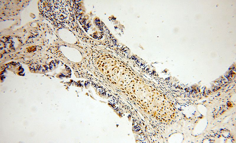 Immunohistochemical of paraffin-embedded human lung using Catalog No:117096(BCL2L10 antibody) at dilution of 1:50 (under 10x lens)