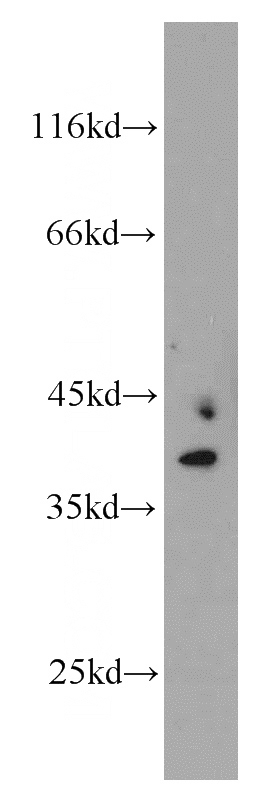 Jurkat cells were subjected to SDS PAGE followed by western blot with Catalog No:112849(MRPS22 antibody) at dilution of 1:300