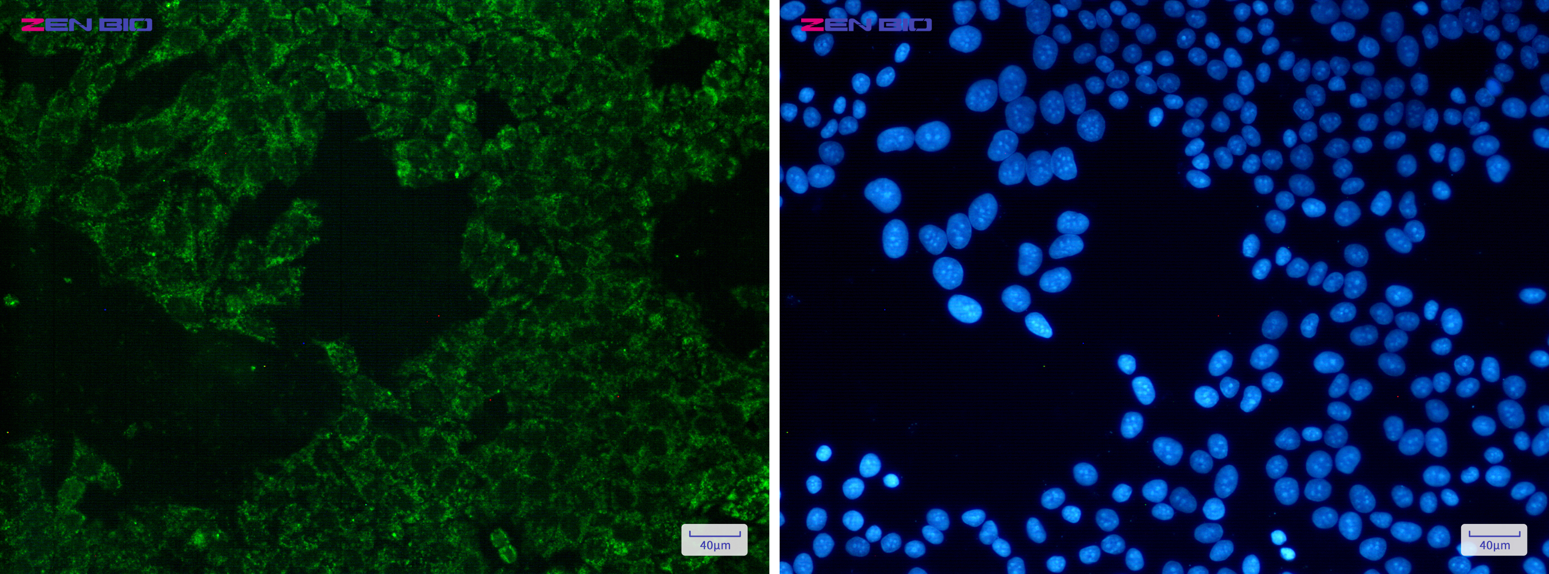 Immunocytochemistry of SEC61A(green) in Hela cells using SEC61A Rabbit pAb at dilution 1/50, and DAPI(blue)