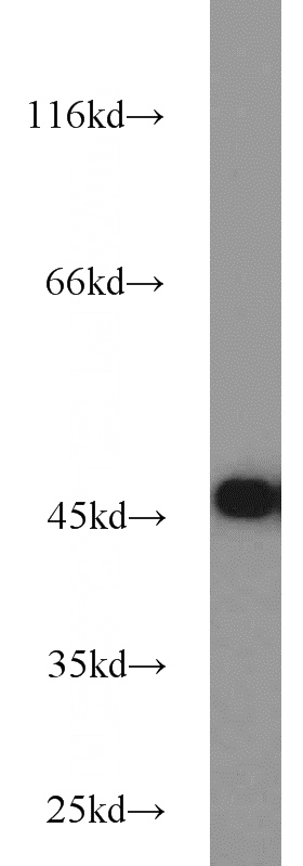 HeLa cells were subjected to SDS PAGE followed by western blot with Catalog No:115117(SEPT2 antibody) at dilution of 1:1000