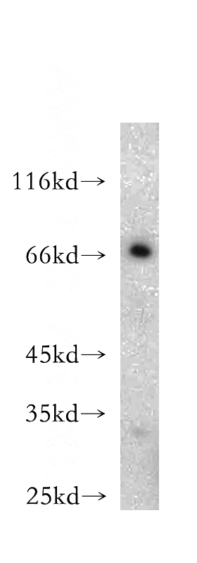 mouse skeletal muscle tissue were subjected to SDS PAGE followed by western blot with Catalog No:108556(BVES antibody) at dilution of 1:500