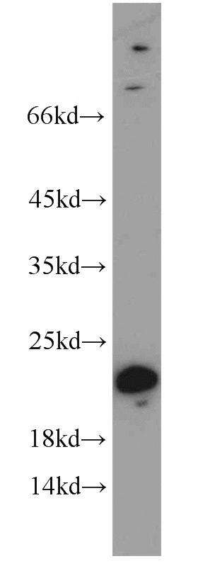 mouse brain tissue were subjected to SDS PAGE followed by western blot with Catalog No:109512(CPLX3 antibody) at dilution of 1:300
