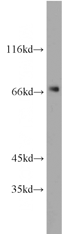 human brain tissue were subjected to SDS PAGE followed by western blot with Catalog No:113790(PGM2 antibody) at dilution of 1:200