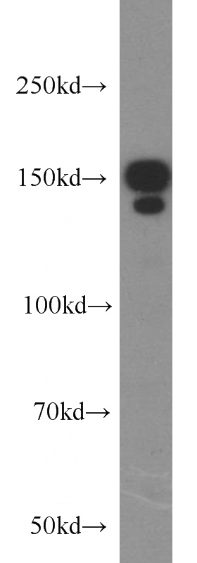 HL-60 cells were subjected to SDS PAGE followed by western blot with Catalog No:110517(FANCD2 antibody) at dilution of 1:300