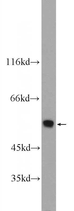 mouse liver tissue were subjected to SDS PAGE followed by western blot with Catalog No:113349(ONECUT1 Antibody) at dilution of 1:600