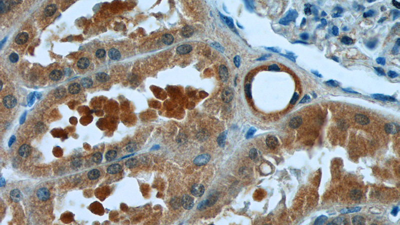 Immunohistochemistry of paraffin-embedded human kidney tissue slide using Catalog No:108293(ATG2A Antibody) at dilution of 1:50 (under 40x lens)