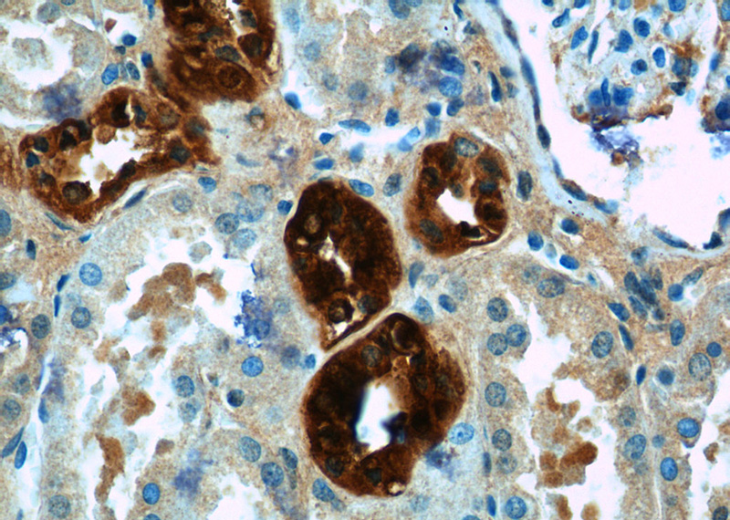 Immunohistochemistry of paraffin-embedded human kidney tissue slide using Catalog No:108815(Calbindin Antibody) at dilution of 1:50 (under 40x lens)