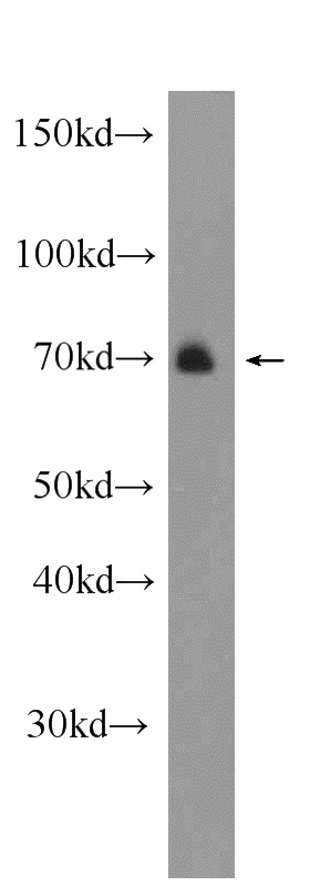 mouse brain tissue were subjected to SDS PAGE followed by western blot with Catalog No:108194(NUAK1 Antibody) at dilution of 1:600