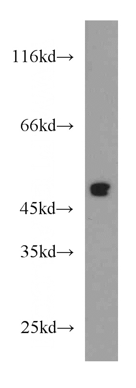 mouse brain tissue were subjected to SDS PAGE followed by western blot with Catalog No:114968(S1PR1 antibody) at dilution of 1:200