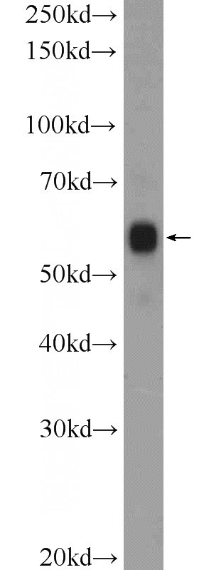 mouse brain tissue were subjected to SDS PAGE followed by western blot with Catalog No:111033(GLRB Antibody) at dilution of 1:1000